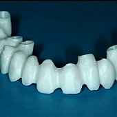 Fertig gefrästes und gebackenes Zirkonoxyd-Gerüst zum Aufbrennen der Keramik.